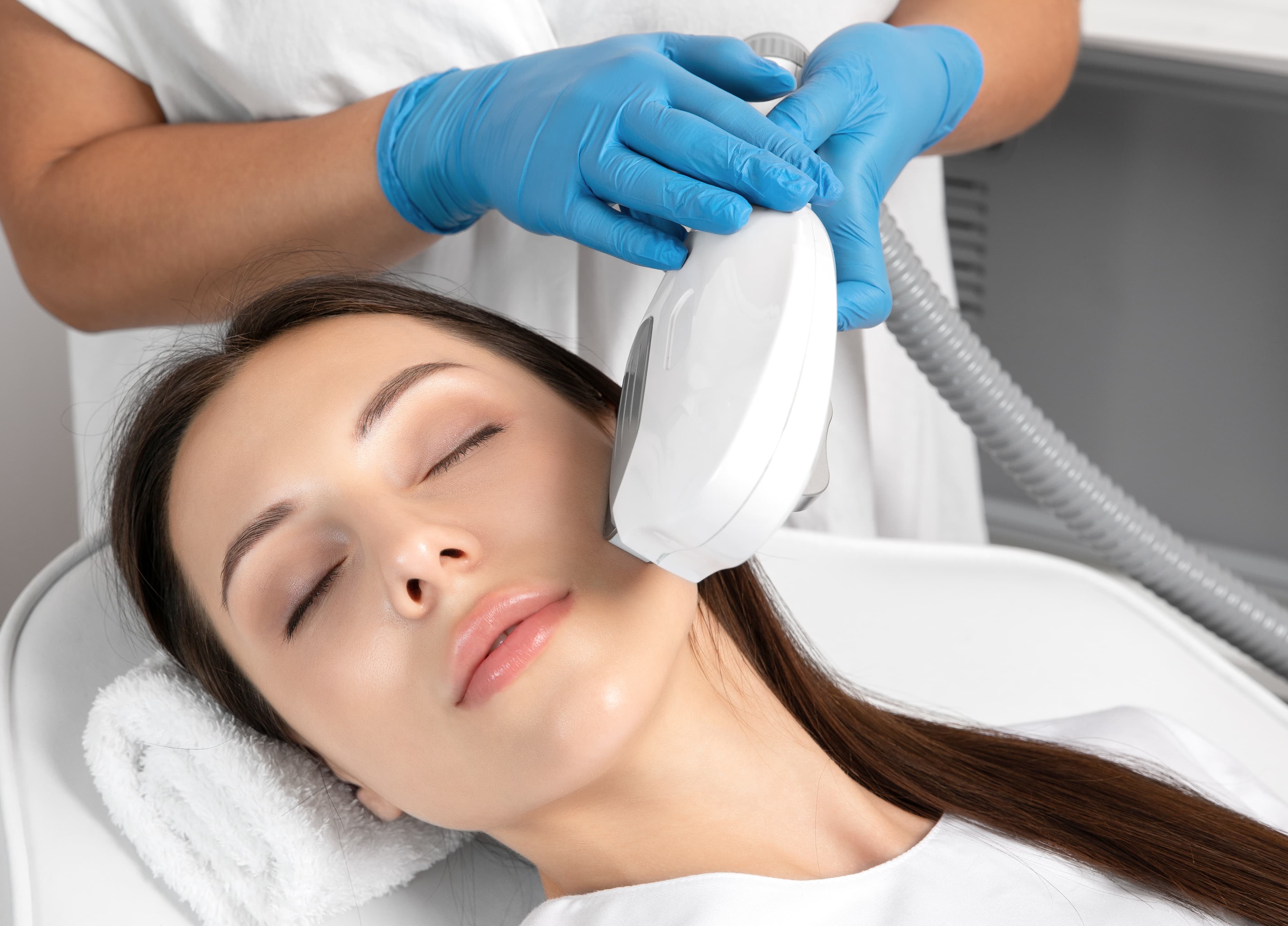 Close-up of Laser Hair Removal Treatment on Face for Smooth, Radiant Skin at MC Aesthetics