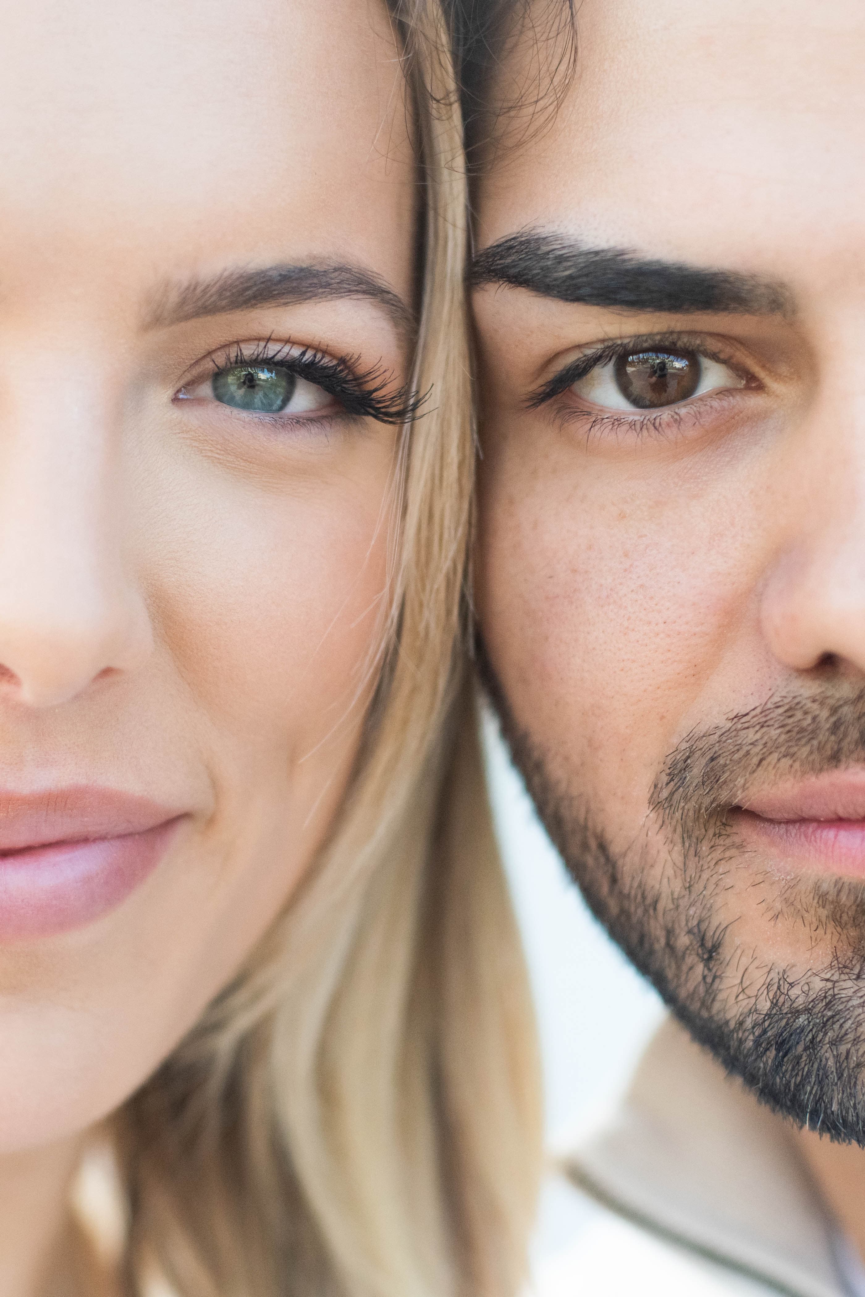 Sculptra filler for collagen boost at MC Aesthetics McMinnville