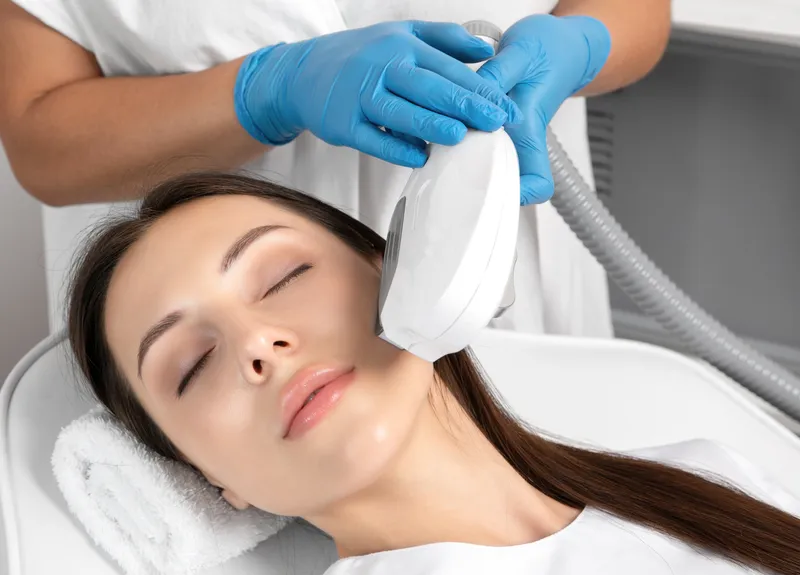 Professional laser hair removal treatment on face at MC Aesthetics