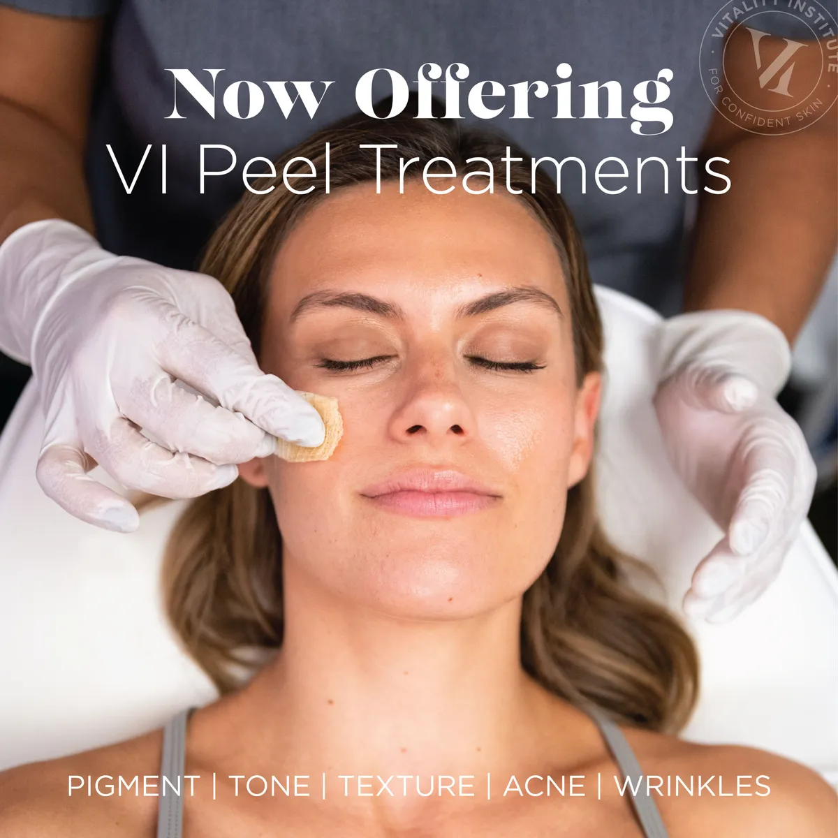 VI Peel Advanced